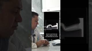 Fractura de radio y cúbito en niños diagnóstico y tratamiento 🌟 Hospitalaria Norte Salud [upl. by Natek]