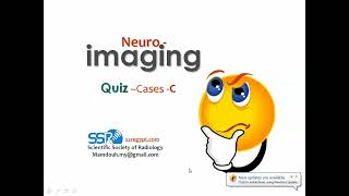 Neuroimaging quiz case  Prof Mamdouh Mahfouz [upl. by Acir208]