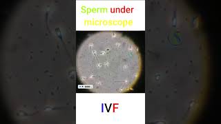 Sperm under microscope microscope IVF fertility life infertility spermmotility california [upl. by Ahsenev]