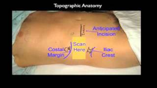 How to Perform an Ultrasound Guided Transversus Abdominis Plane TAP Block [upl. by Dera]