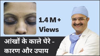 आंखों के काले घेरे  कारण और उपाय Under Eye Dark Circles Causes amp Treatments  In HINDI [upl. by Mattland]