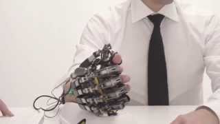 Hand of Hope  robotic arm after stroke rehabilitation exercise [upl. by Fulbright63]