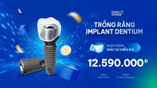 Trồng răng Implant Dentium nhanh chóng an toàn  quotXóa bỏquot lo toan [upl. by Clarie]