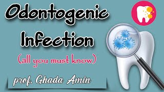 Odontogenic Infection  prof Ghada Amin [upl. by Shiverick]