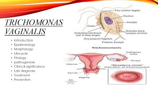 Trichomonas vaginalis [upl. by Margreta]