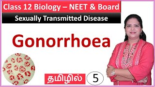 Reproductive Health  Gonorrhoea Class 12 Biology [upl. by Etteb933]