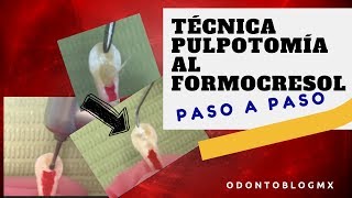 Técnica PULPOTOMÍA AL FORMOCRESOL  paso a paso [upl. by Novello]