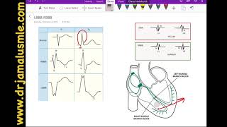 LBBB and RBBB left VS right bundle branch block Dr Jamal USMLE  Cardiology ECG lecture [upl. by Ojybbob]