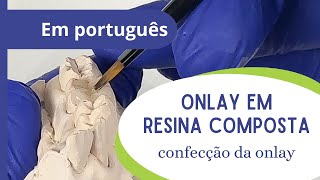 Onlay em resina composta  parte 4 confecção da onlay [upl. by Pascia]