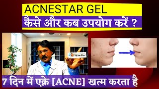 Acnestar creamकब और कैसे लगाना चाहिए  AcneStar Gel Review Acnestar gel Price Uses amp Side Effect [upl. by Udelle]