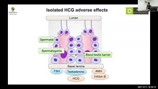 MedEClasses Module Hypogonadotropic Hypogonadism Treatment [upl. by Tocci]