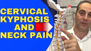 Cervical Kyphosis And Neck Pain REVERSAL CERVICAL LORDOSIS Dr Walter Salubro Chiropractor In Vaughan [upl. by Supen]