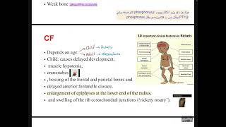 MBD4osteoporosis and osteomalacia [upl. by Oleic]