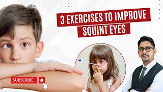 How To Fix Squint Eyes  Squint Eyes Meaning  Squint Eyes Treatment [upl. by Honniball]