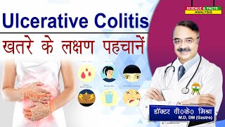 ULCERATIVE COLITIS ख़तरे के लक्षण पहचानें  ASK THE EXPERT HOW SERIOUS IS ULCERATIVE COLITIS [upl. by Ahsatel747]