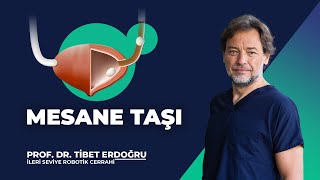 Mesane Taşı  Prof Dr Tibet Erdoğru [upl. by Dnalyag]