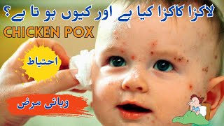 Chicken Pox Causes Symptoms Preventions amp Treatment  Doctors News Times [upl. by Case]