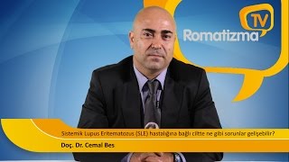 Sistemik Lupus Eritematozus SLE hastalığına bağlı ciltte ne gibi sorunlar gelişebilir [upl. by Eiliak]