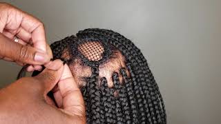 Box Braids Alopecia IGirenesbraids [upl. by Okoy502]