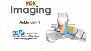 Ankle joint imaging II PT Prof Mamdouh Mahfouz [upl. by Ecineg]