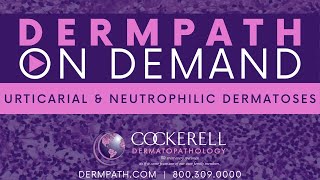 Urticarial and Neutrophilic Dermatoses [upl. by Hsetim]