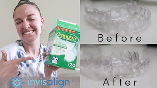 INVISALIGN UPDATE Tips and Tricks for Clean Trays No Stains or Smelly Trays  DEMO [upl. by Llennahs]