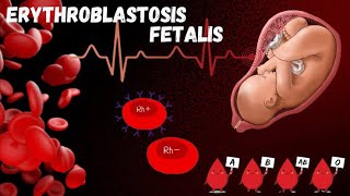 228 Erythroblastosis Foetalis  Maternal Foetal Rh Incompatibility  Class 12  Biology [upl. by Eldon65]