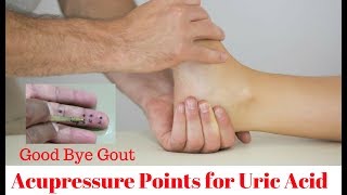 How to Control Uric Acid by Sujok Acupressure [upl. by Ben]