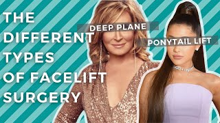 Facelift 101 Ponytail Lift vs Deep Plane Facelift vs Mini Lift [upl. by Artenal912]