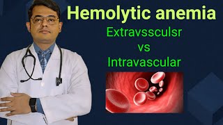 Hemolytic anemia Extravsscular vs Intravascular  Simplified explanation [upl. by Nelrac271]