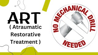 ARTatraumatic Restorative Treatment Public Health Dentistry [upl. by Eednarb128]