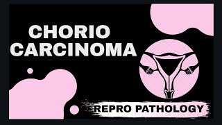 Invasive Mole and Choriocarcinoma  Female reproductive system pathology  Med Bees [upl. by Jerrold]