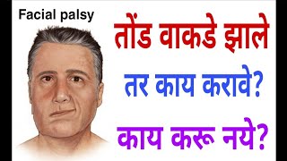 Facial palsyतोंड वाकडे झाले तर तात्काळ काय करावेकाय करू नयेBells palsy562drramjawale [upl. by Erickson]