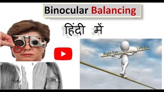 Binocular balancing Made easy in Hindi [upl. by Ezalb]