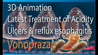 3D Animation Latest Treatment for Gastric amp duodenal ulcer GERD esophagitis Vonoprazan vs PPI MOA [upl. by Octave]