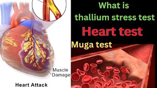 thallium stress test for heartthallium stress testthallium stress test in hindimuga test [upl. by Fatsug75]