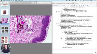 Integument5 Dermis amp Hypodermis [upl. by Kidd899]