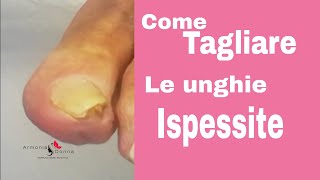 Tutorial come TAGLIARE le UNGHIE ISPESSITE ArmoniaDonna GraziaSantangelo [upl. by Nylecsoj478]