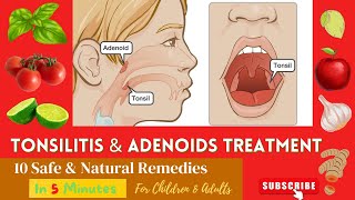 10 Best Effective Proven Home Remedies For Enlarge  Swelling ADENOIDS and TONSILS In Children [upl. by Ahseinet]