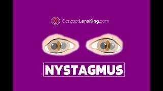 Nystagmus Eyes Explained  Involuntary Repetitive Eye Movement [upl. by Elletnohs]