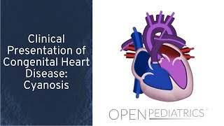 Acyanotic Congenital Heart Disease  cardiology  5th grade  Dr Mohamed AboelKassem [upl. by Baumbaugh431]