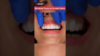 Microdontia Small size Teeth Treated via Porcelain Veneers shorts veneers dentition viral [upl. by Petite800]