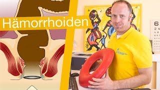 Hämorrhoiden ⚡️ Erkennen Behandeln amp Hilfsmittel [upl. by Kcirted]