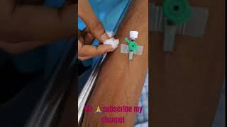 IV canalization part 2 shortvideo Viral  Medical vuralvideo youtubeshorts likes [upl. by Giselle661]