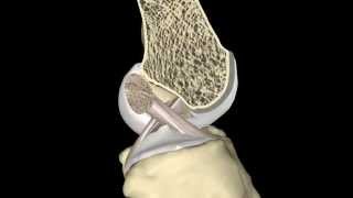 The ACL During Knee Range of Motion [upl. by Nwahsid493]