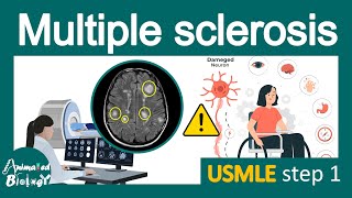 Multiple Sclerosis  Pathology Immunology  diagnosis and treatment of MS  USMLE step 1 [upl. by Isia]