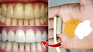 Magical Teeth Whitening home Remedy Get whiten Teeth at home in 3 minutes [upl. by Nahshunn887]