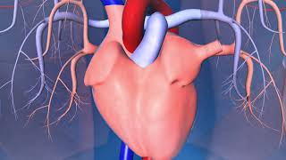 Catheter Ablation What is it and how does it help an irregular heart beat [upl. by Otes785]