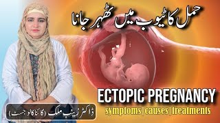 What is Ectopic pregnancy  Risk factorssymptoms and Treatment of Ectopic Pregnancy by Dr Zainab [upl. by Hanyaz34]