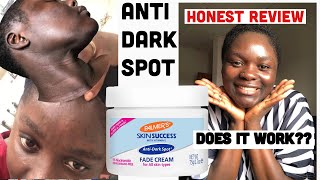 Palmer’s Skin Success Fade Cream Honest Review Dark Spot and Eventone Face Cream [upl. by Vito]